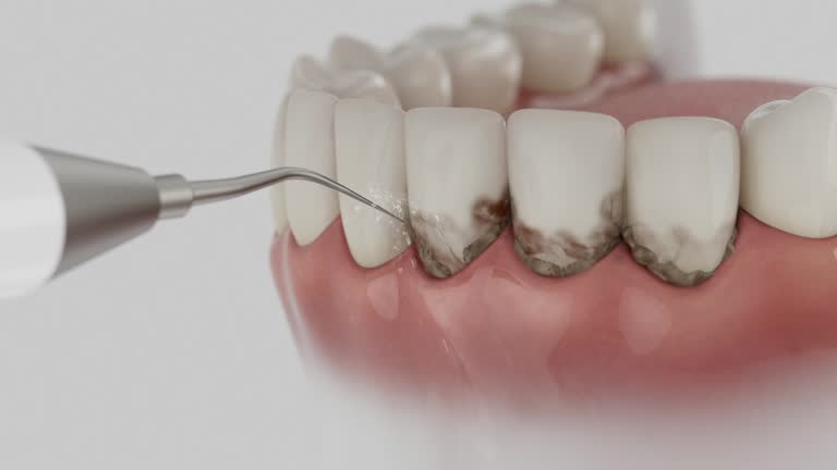 Trusted Teeth Cleaning And Checkup service in North Lakeville, MA - Dentist Open Now